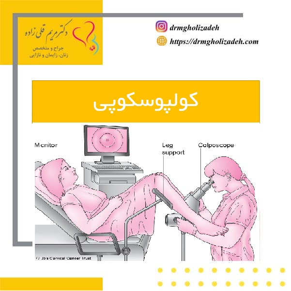 کولپوسکوپی