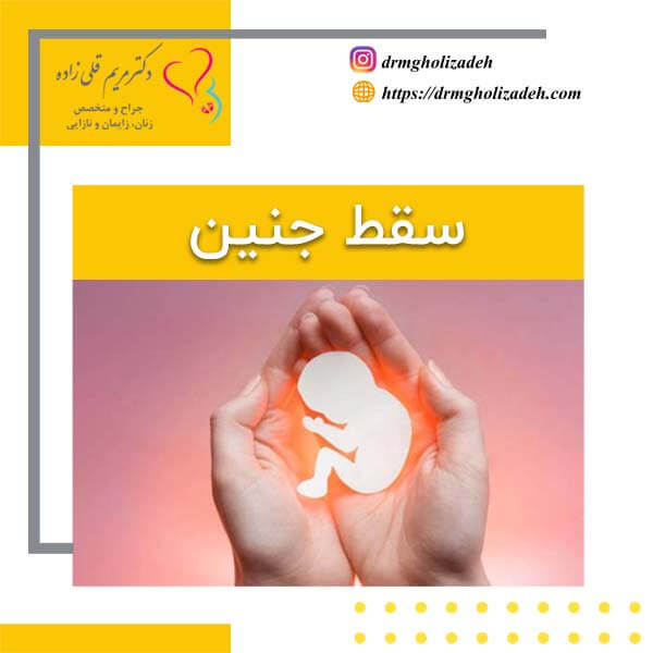 سقط جنین